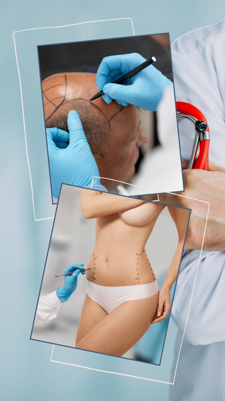 SAÇ EKİMİ VE ESTETİK